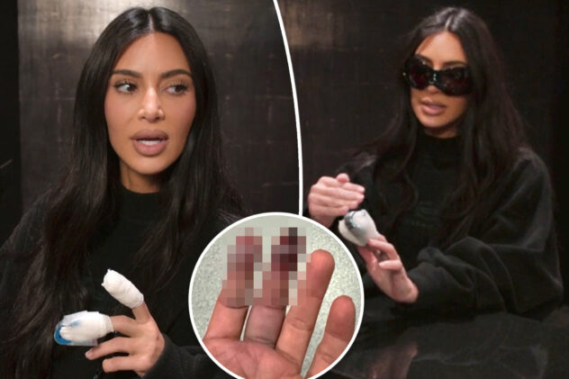 Kim Kardashian says sliding door caused gruesome finger injury: My bone was ‘sticking out a little bit’