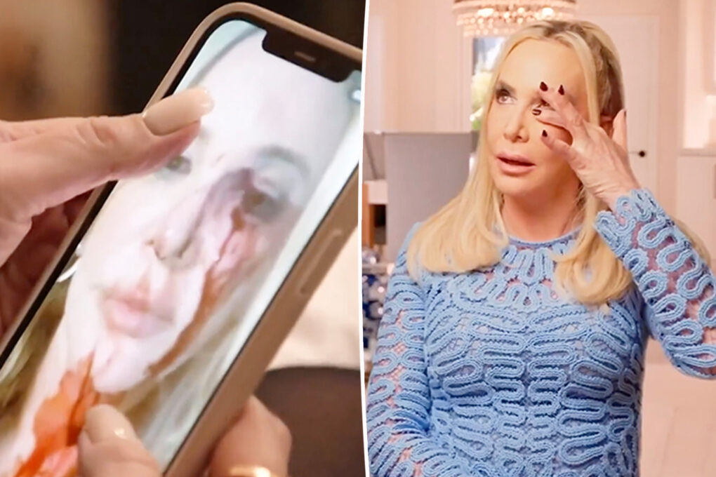 Shannon Beador ‘shocked’ by her bloody selfie after DUI: ‘Really traumatic for me’
